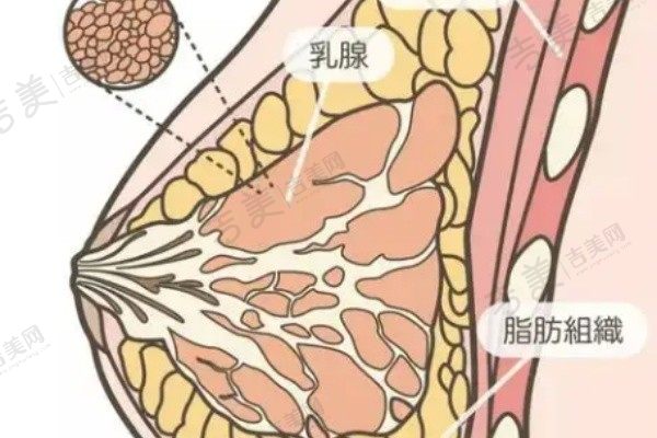 项力源丰胸价格53000元左右体验：全面解析自体脂肪丰胸手术的安全性、效果及性价比