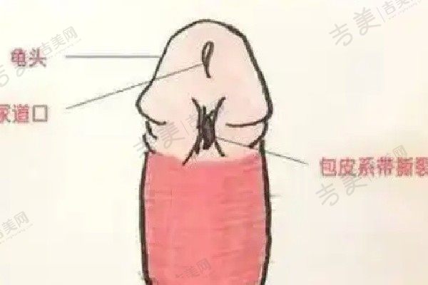 李世荣增长增大手术8W左右特别值得,手术隐痕术后体验好就在私密性非常好的重庆星荣男科医院