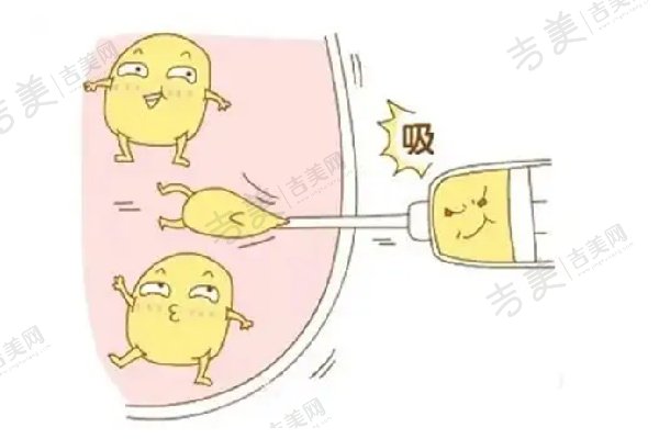 北京艺美王东脂肪修复术前沟通