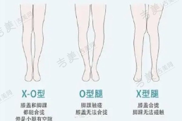 北京艺美王东脂肪修复对比与反思