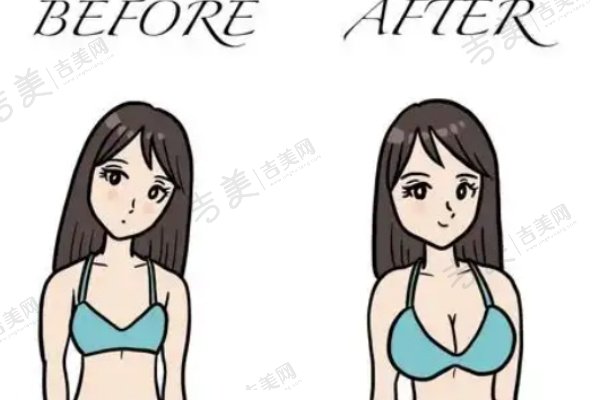 丰胸项目市场价医院价格差异