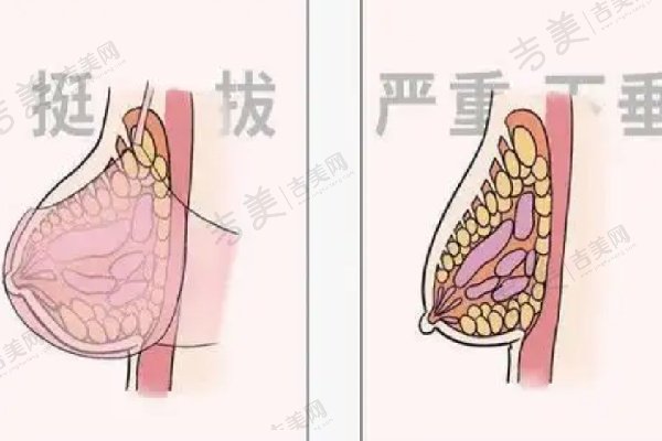 项力源丰胸常见问题解答