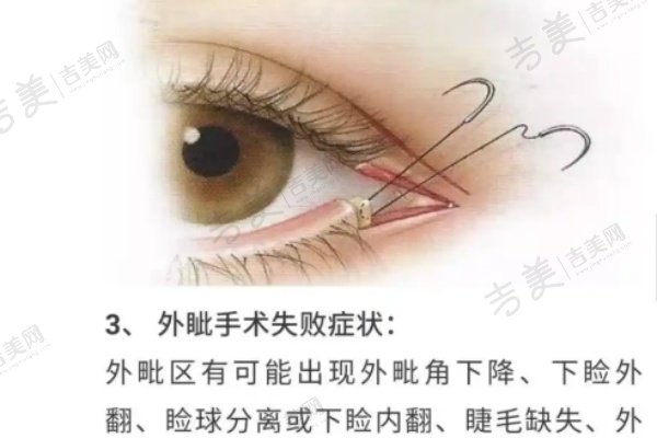 北京丰联丽格整形医院师丽丽医生的技术优势及推荐
