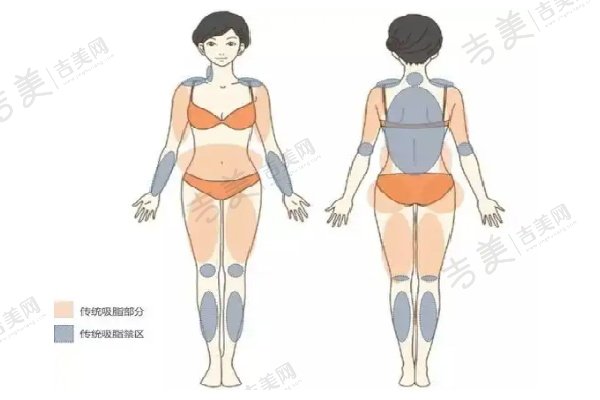 王明利医生脂肪填充项目价格具体内容