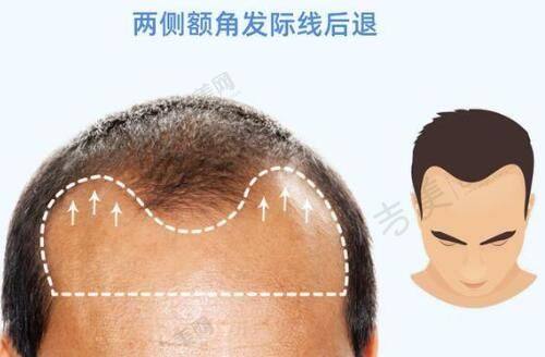 李伟杰医生擅长的整形项目
