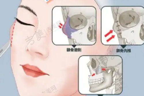 王志军 医生擅长的整形项目