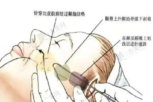 唐红伟医生的技术优势体现