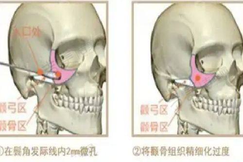李伟杰医生的口碑评价及反馈内容