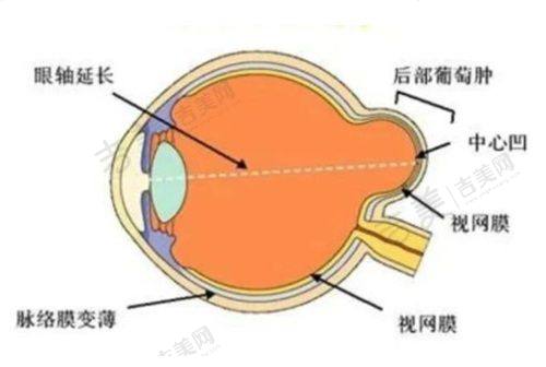 兰州华厦眼科燕振国医生近视手术技术怎么样