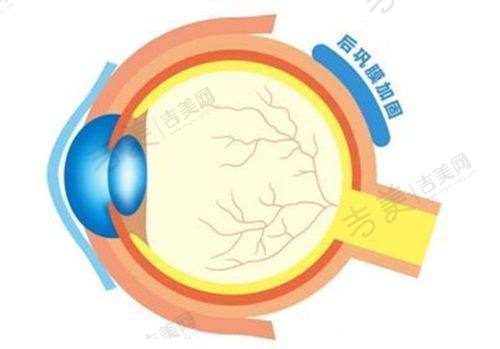兰州华厦眼科近视手术技术实力如何,设备精良吗