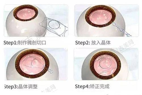 三亚301眼科医院地址在哪里？好找不？