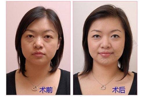宁波艺星时代美容医院价格表