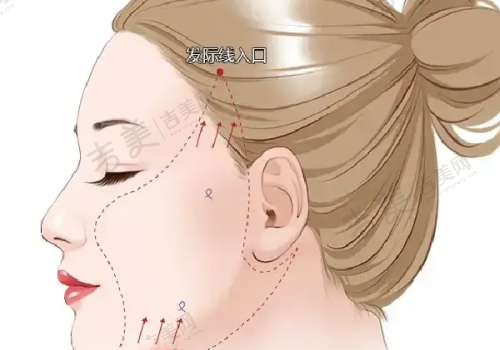 宁波艺星时代美容医院口碑好不好?附真实患者口碑评价
