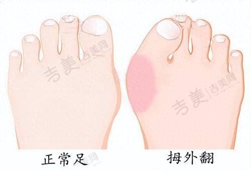 河源华美医疗整形美容医院怎么样,口碑评价如何?