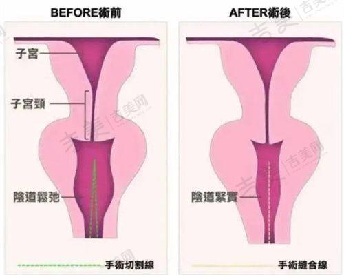 庆阳华美整形美容中 心地址及乘车路线