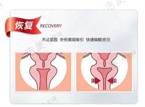 宁德华美整形美容医院价格表