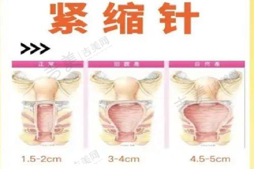 薛美思医生个人资料深度解析