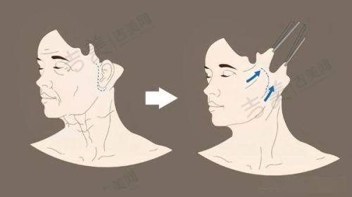 河源华美医疗整形美容医院口碑好不好?附真实患者口碑评价