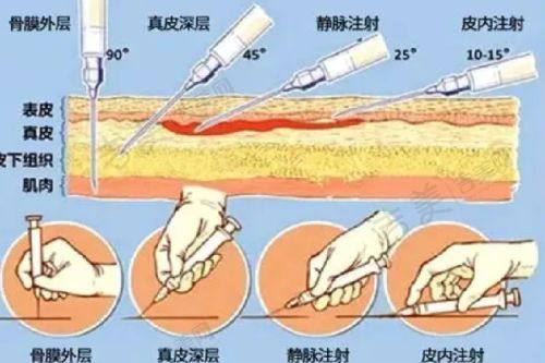 亳州华美整形美容医院价格表