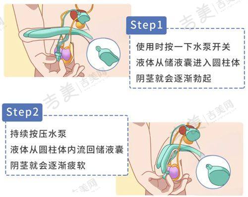 合肥华美整形医院价格表