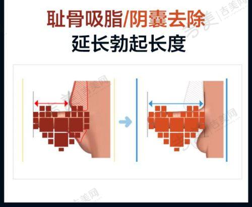 梧州华美医疗美容门诊部项目特色