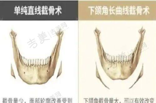 宁波华美医疗美容医院价格表
