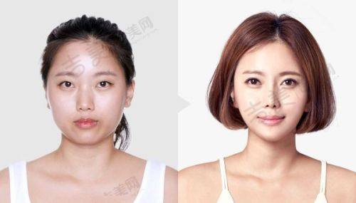 兰州华美整形医院口碑好不好?附真实患者口碑评价