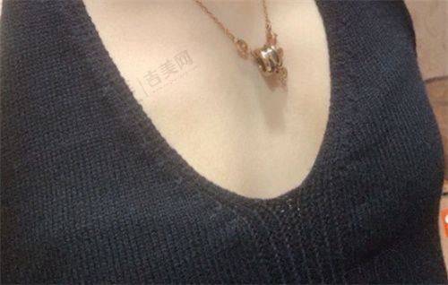 兰州华美整形医院价格表