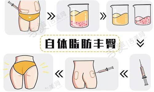 天津华美医疗美容医院怎么样,口碑评价如何?