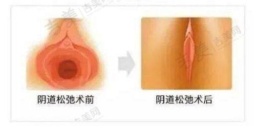 邯郸华美整形美容医院口碑好不好?附真实患者口碑评价