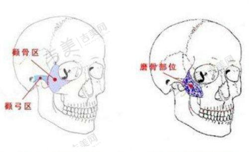 揭阳华美整形美容医院医生简介