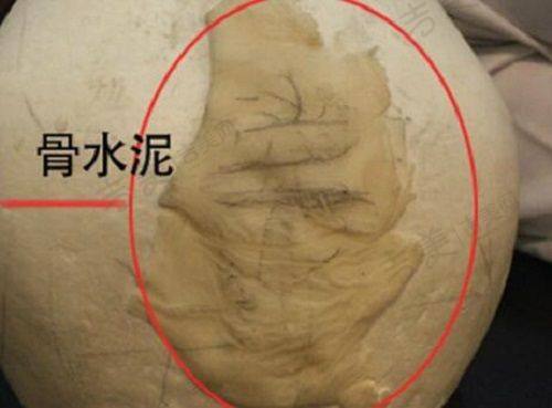 南充华美名媛医疗美容门诊部项目特色
