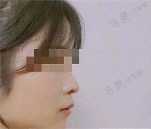 武汉华美医疗整形美容医院怎么样,口碑评价如何?