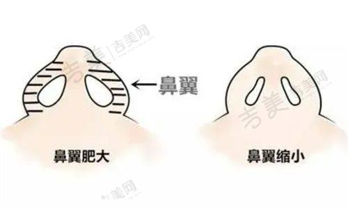 宿迁华美创和医疗美容诊所项目特色