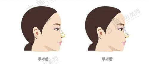 南充华美名媛医疗美容门诊部怎么样,口碑评价如何?
