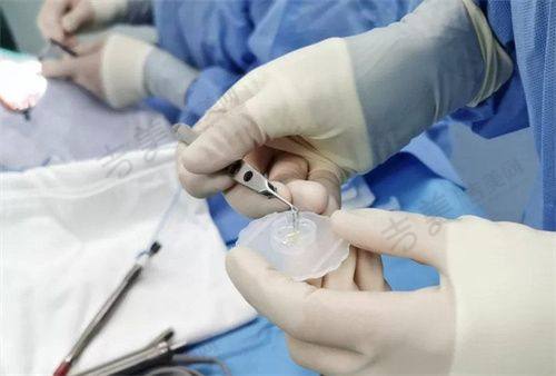 南昌大学第二附属医院眼科激光近视手术价格