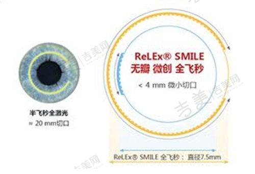 安徽合肥慧视眼科医院后巩膜加固价格详情