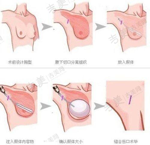 河源华美医疗整形美容医院地址及乘车路线