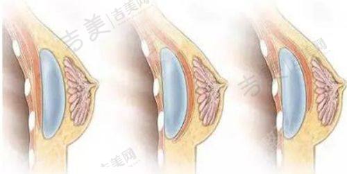 桂林华美医疗美容门诊部怎么样,口碑评价如何?