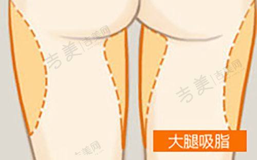 邗江区华美整形外科门诊部怎么样,口碑评价如何?