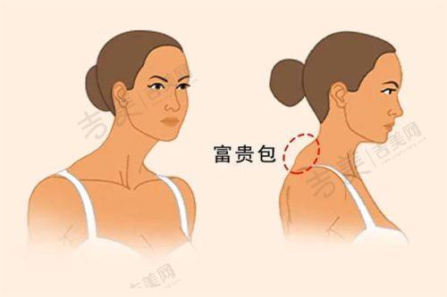 岳阳华美医疗美容门诊部口碑好不好?附真实患者口碑评价