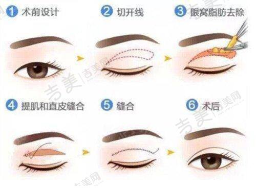 宁德华美整形美容医院项目特色