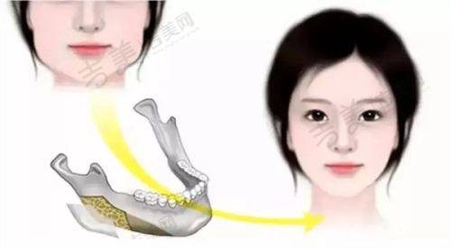 广州华美医疗美容医院医生简介