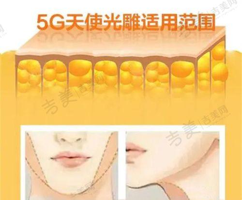 铜仁华美医疗美容门诊部怎么样,口碑评价如何?