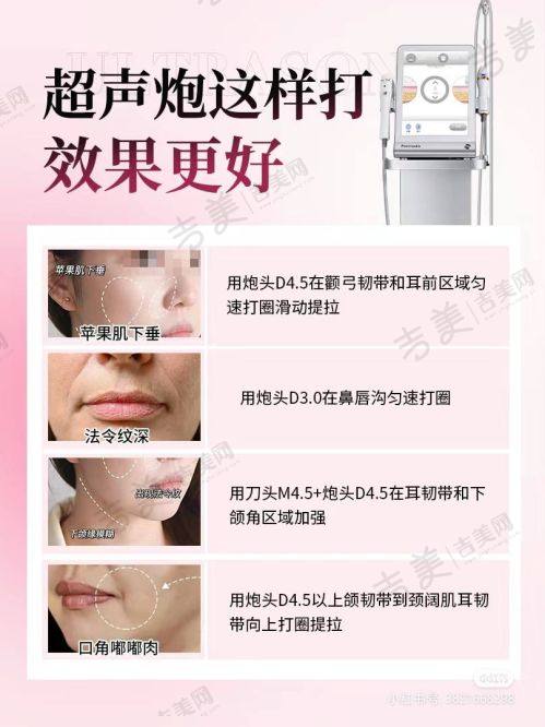 岳阳华美医疗美容门诊部项目特色