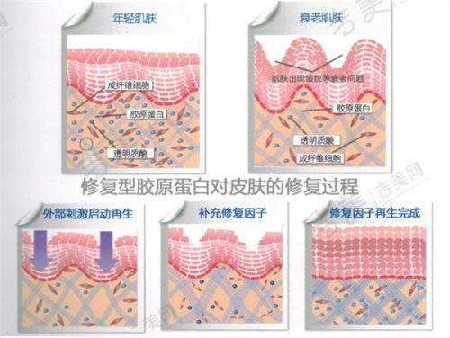 福州美莱华美美容医院项目特色