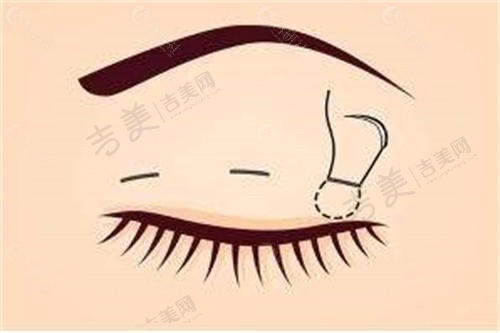 岳阳华美医疗美容门诊部怎么样,口碑评价如何?