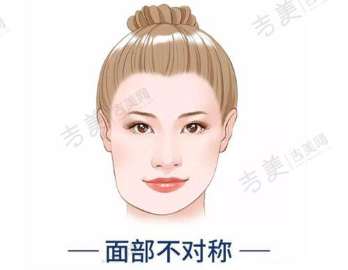 滨州华美整形医院怎么样，口碑评价如何？