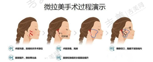 宿迁华美创和医疗美容诊所价格表