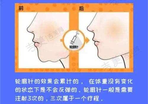 广州华美医疗美容医院价格表